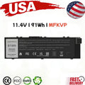 ?New MFKVP Battery For Dell Precision 15 7510 7520 17 7710 7720 M7510 M7710 91Wh