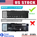 91Wh MFKVP Laptop Battery For Dell Precision 7510 7710 RDYCT D7YCT 0TWCPG T05W1